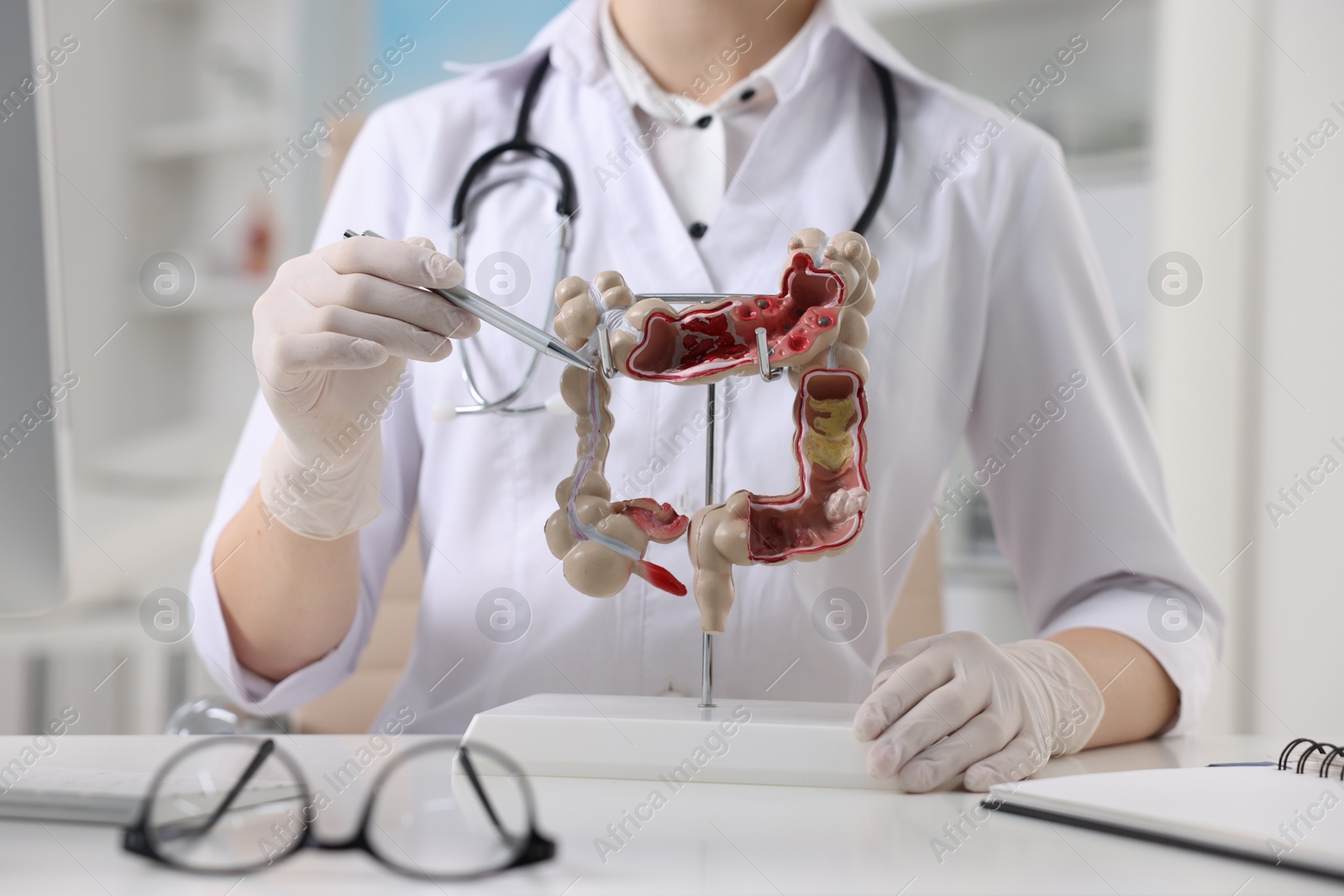 Photo of Gastroenterologist showing anatomical model of large intestine at table in clinic, closeup