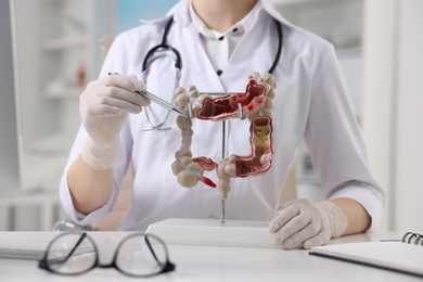 Gastroenterologist showing anatomical model of large intestine at table in clinic, closeup