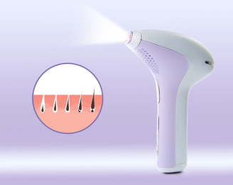Image of Epilation procedure. Modern appliance and illustration of hair follicle growth on light background