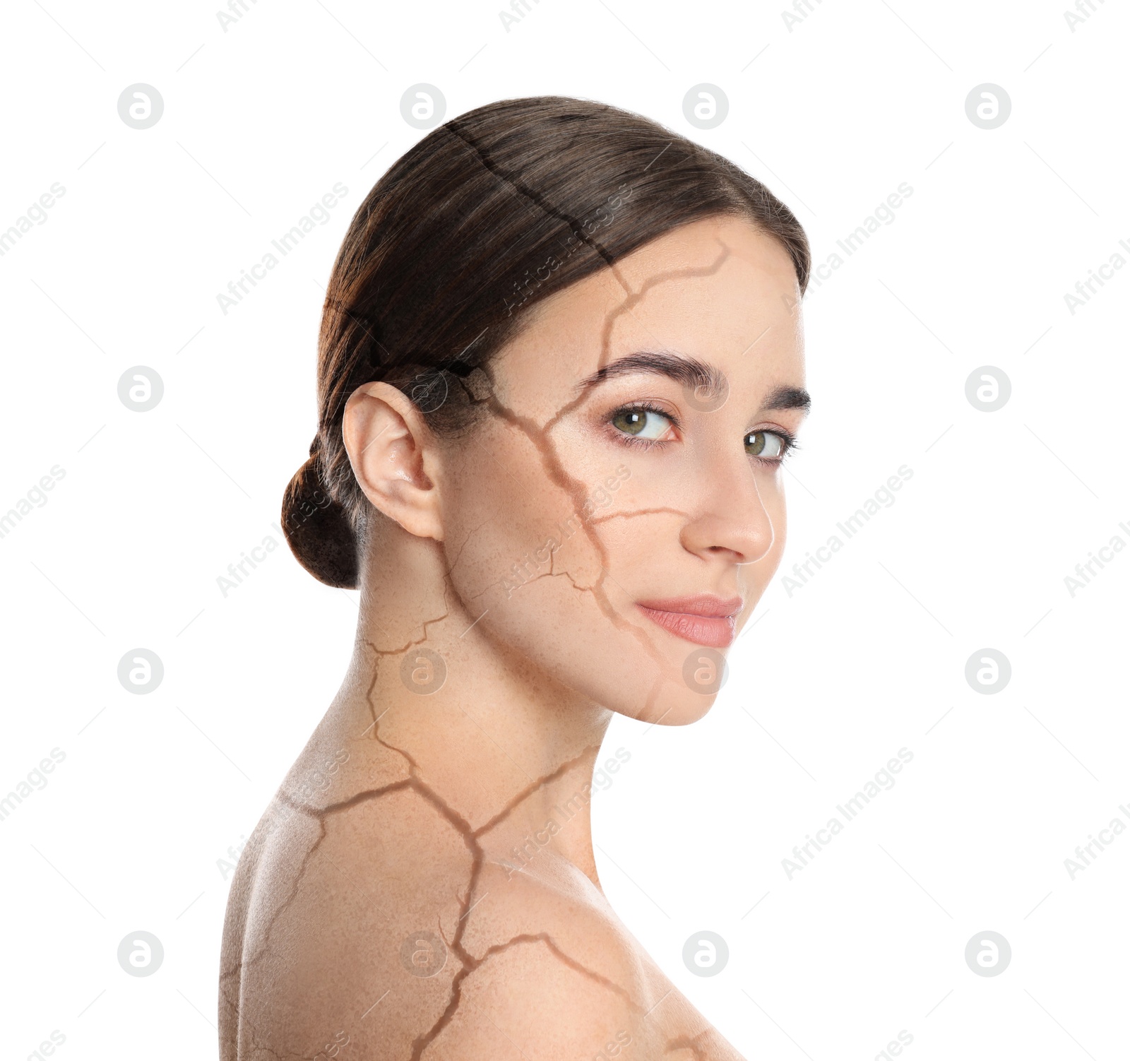 Image of Young woman with body dry skin problem on white background