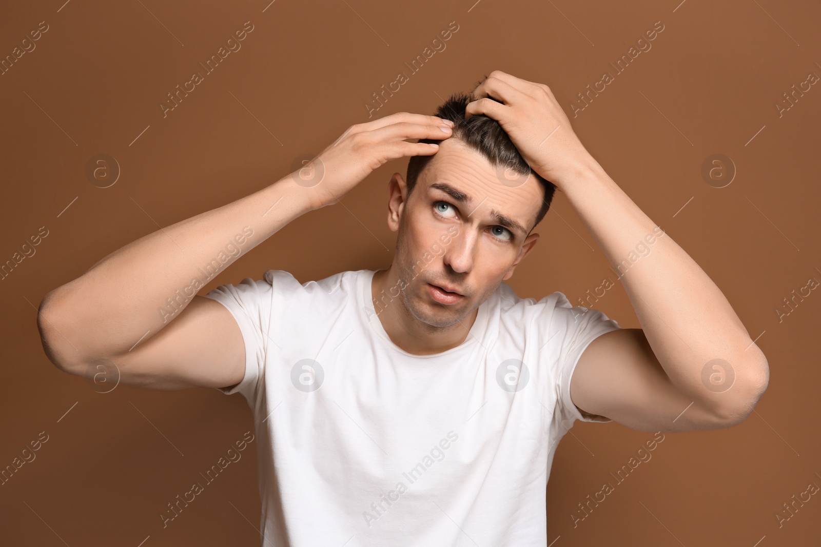 Photo of Young man with hair loss problem on color background