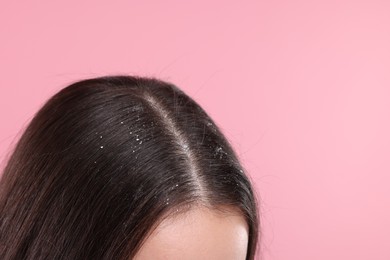 Photo of Woman with dandruff problem on pink background, closeup. Space for text
