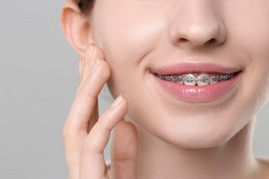 Photo of Smiling woman with dental braces on grey background, closeup