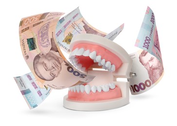 Image of Model of oral cavity with teeth and hryvnia banknotes on white background. Concept of expensive dental procedures