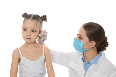 Photo of Doctor examining little girl with chickenpox on white background. Varicella zoster virus