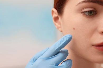 Dermatologist in rubber glove examining patient's birthmark on blurred background, closeup