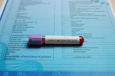 Photo of Liver Function Test. Tube with blood sample and laboratory form on table