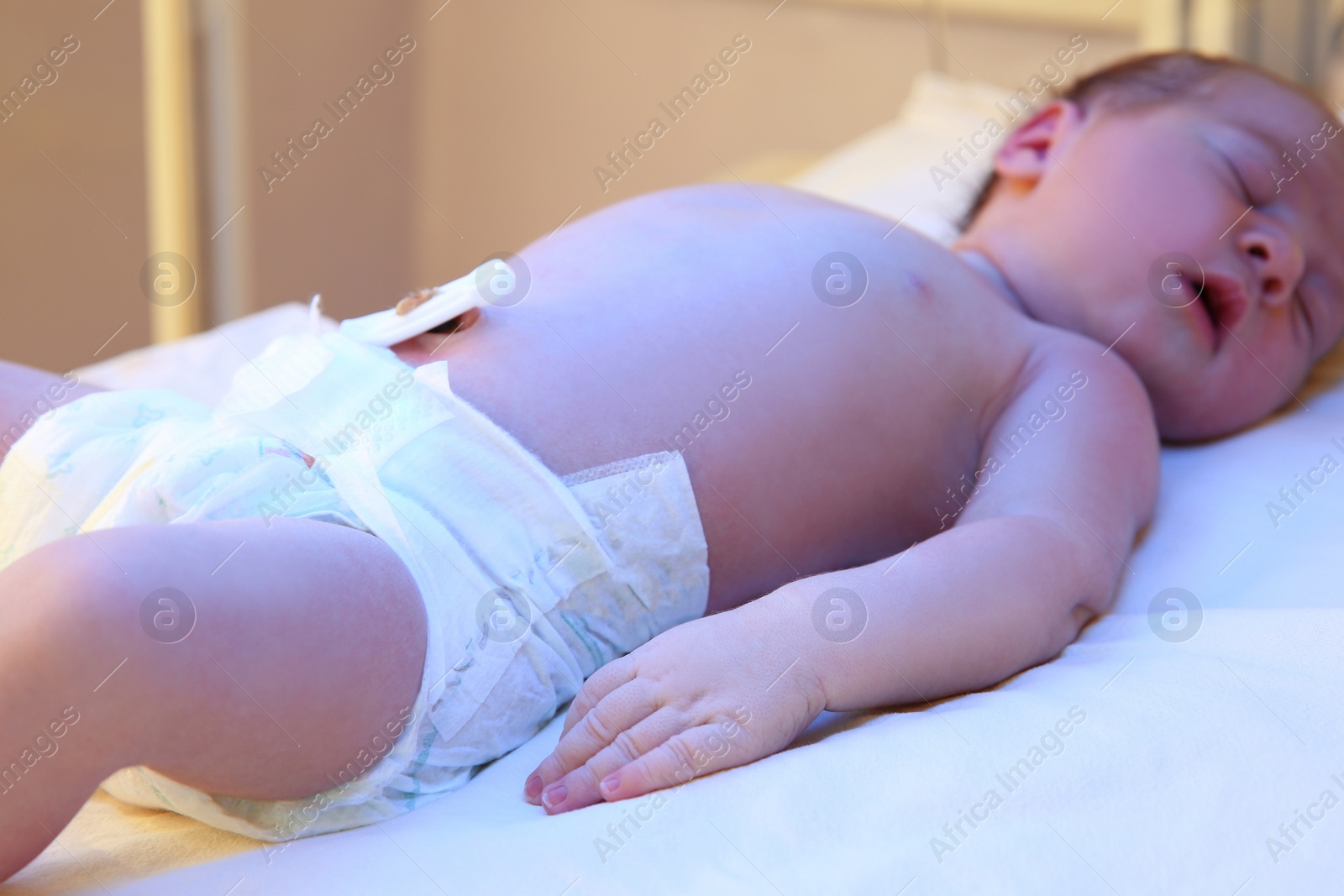 Photo of Newborn child under ultraviolet light in hospital