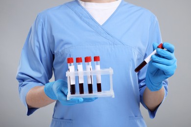 Photo of Laboratory testing. Doctor with blood samples in tubes on light grey background