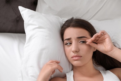 Young woman with eyelash loss problem resting in bed