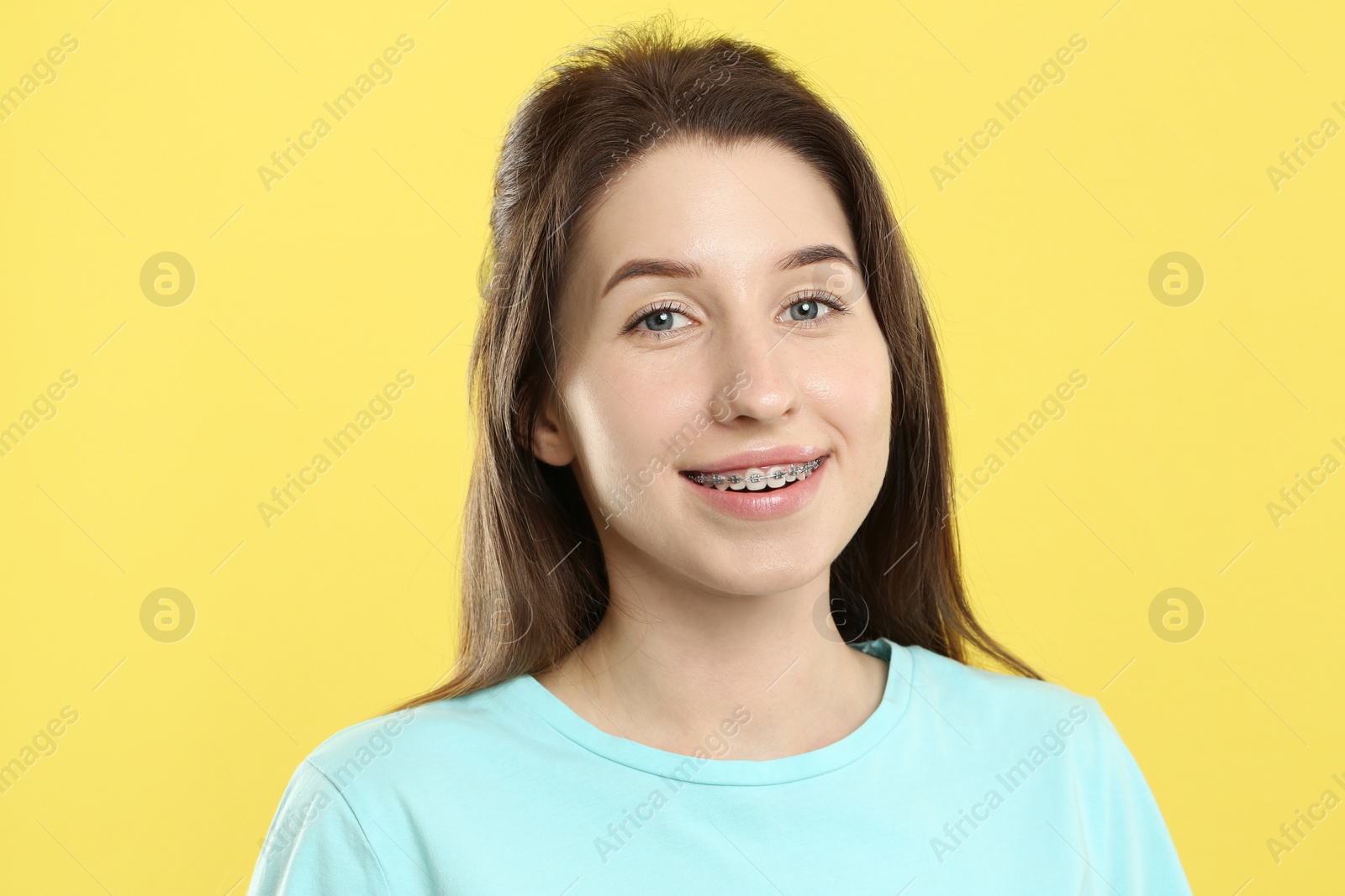 Photo of Portrait of smiling woman with dental braces on yellow background
