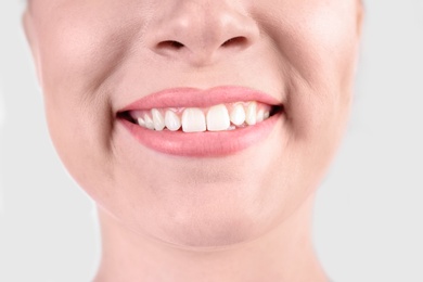 Photo of Young woman with healthy teeth smiling on white background, closeup