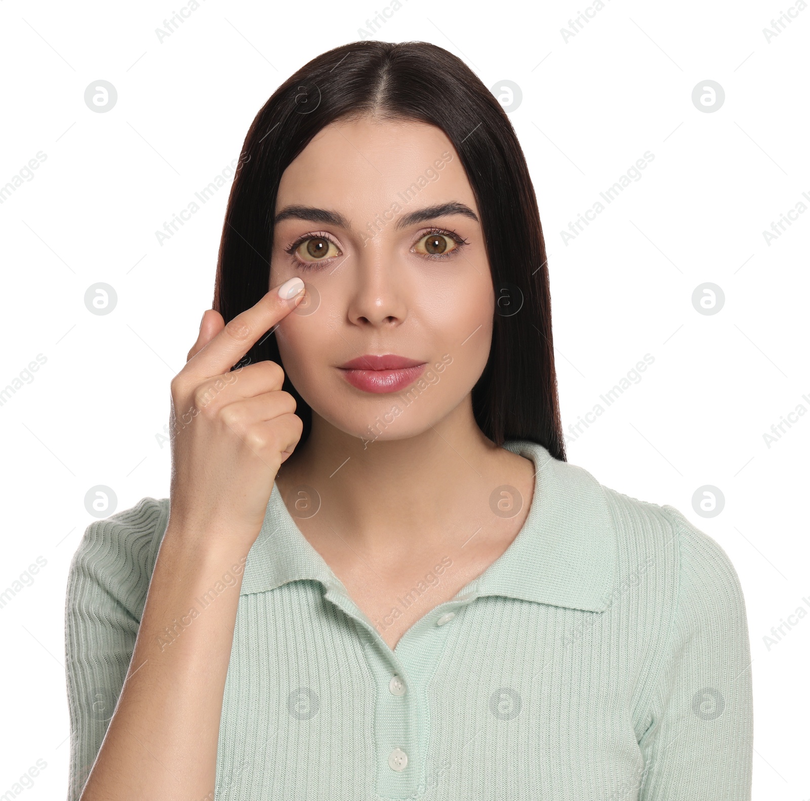 Photo of Woman checking her health condition on white background. Yellow eyes as symptom of problems with liver