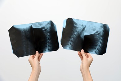 Photo of Doctor examining neck MRI images on light grey background, closeup