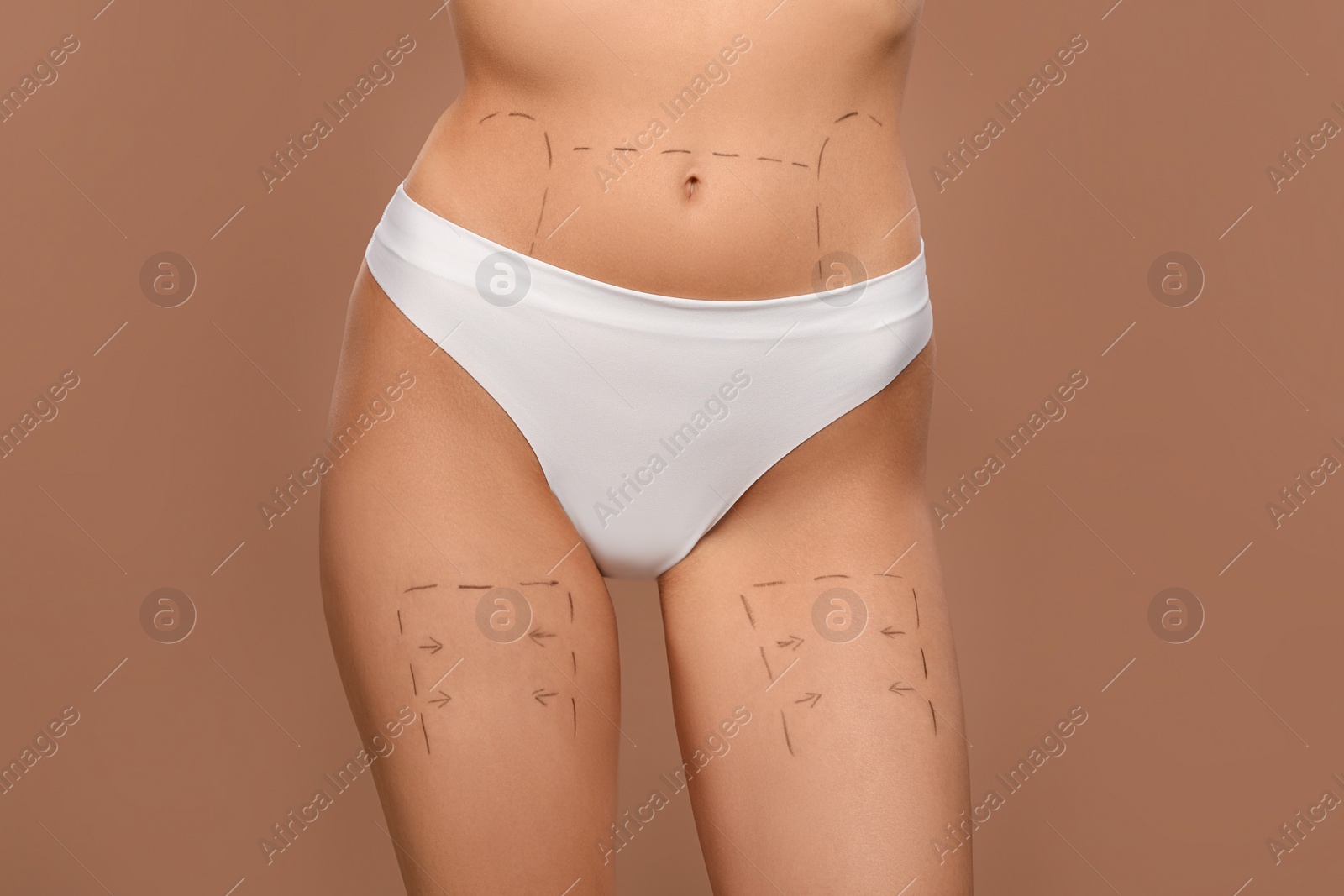 Photo of Slim woman with markings on body before cosmetic surgery operation on light brown background, closeup