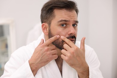 Photo of Skin problem. Man touching his face indoors