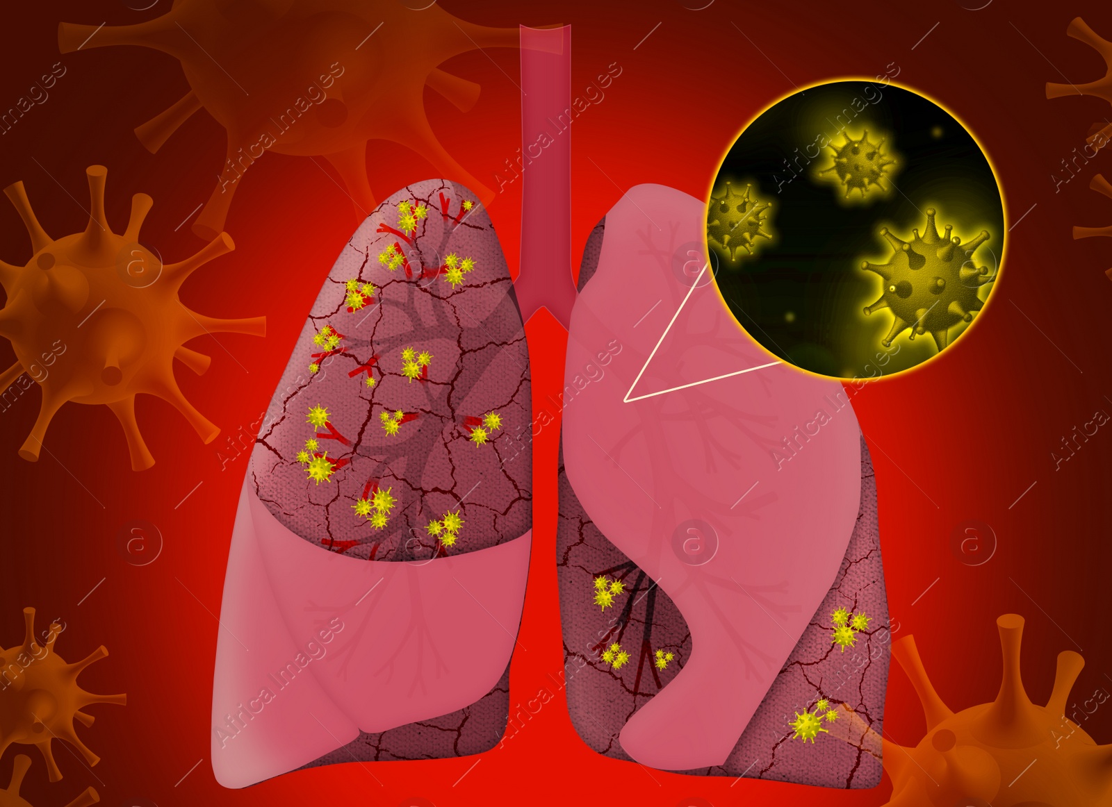 Illustration of  human lungs affected with disease on red background