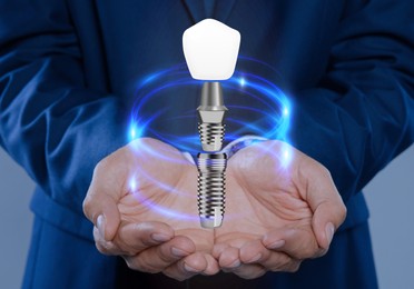 Image of Man demonstrating dental implant on light background, closeup