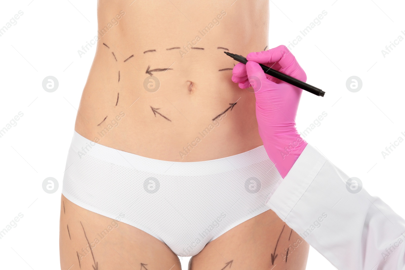 Photo of Doctor drawing marks on woman's body isolated on white. Cosmetic surgery