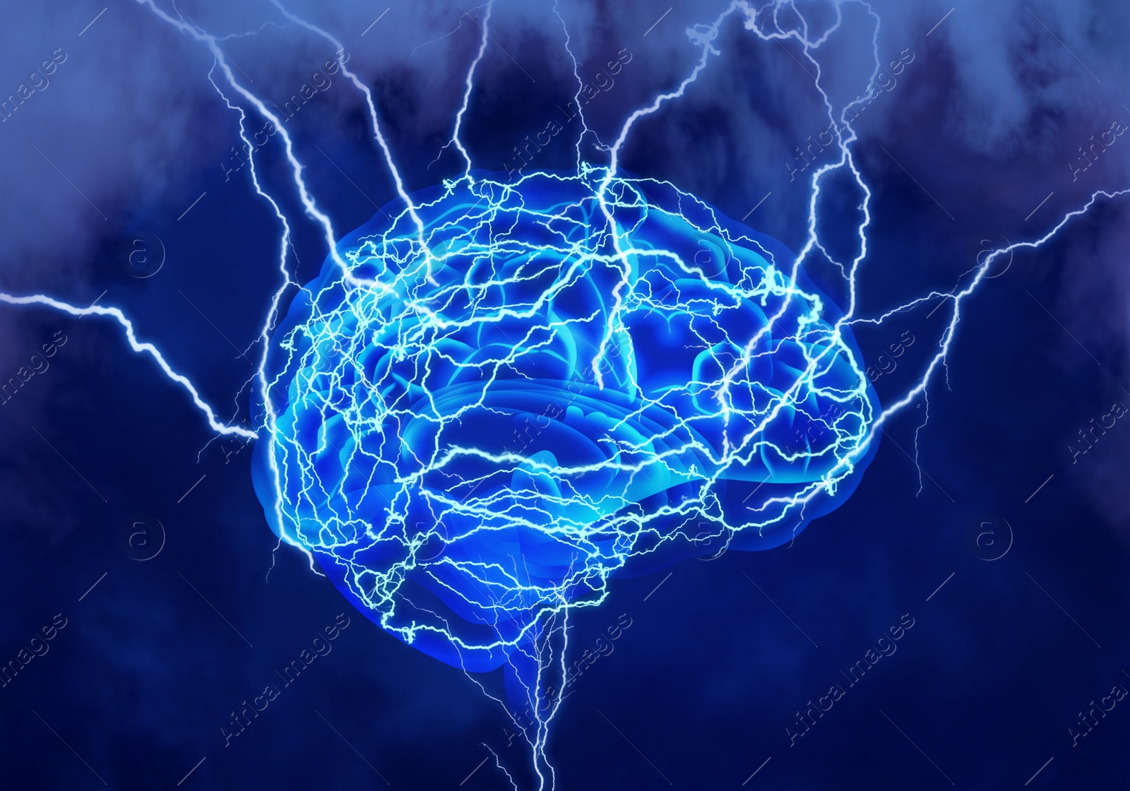 Illustration of  human brain with lightning strikes on blue background