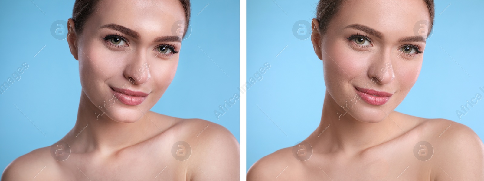 Image of Collage with photos of beautiful young woman before and after using mattifying wipes on light blue background. Banner design