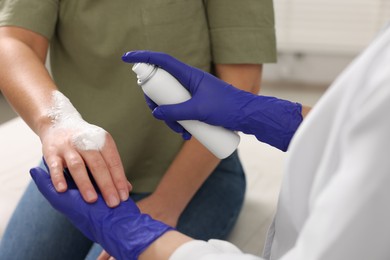Photo of Doctor applying panthenol onto patient's burned hand in clinic, closeup