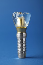 Photo of Educational model of dental implant on blue background