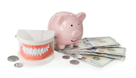 Educational dental typodont model, piggy bank and money on white background. Expensive treatment