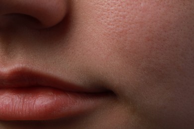 Photo of Closeup view of woman with normal skin and beautiful lips