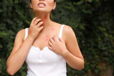 Woman scratching neck with insect bites in park, closeup