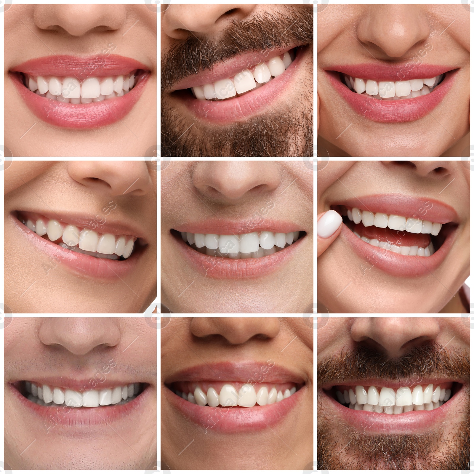 Image of People showing white teeth, closeup. Collage of photos