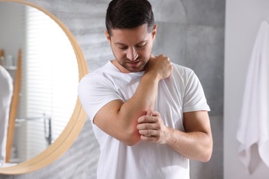 Photo of Man suffering from allergy scratching his arm indoors