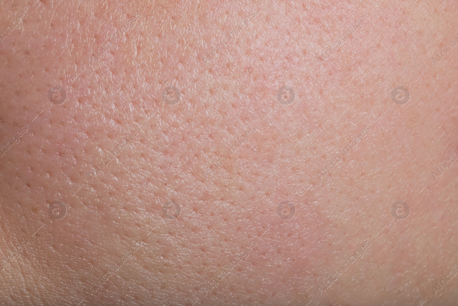 Photo of Closeup view of human skin as background