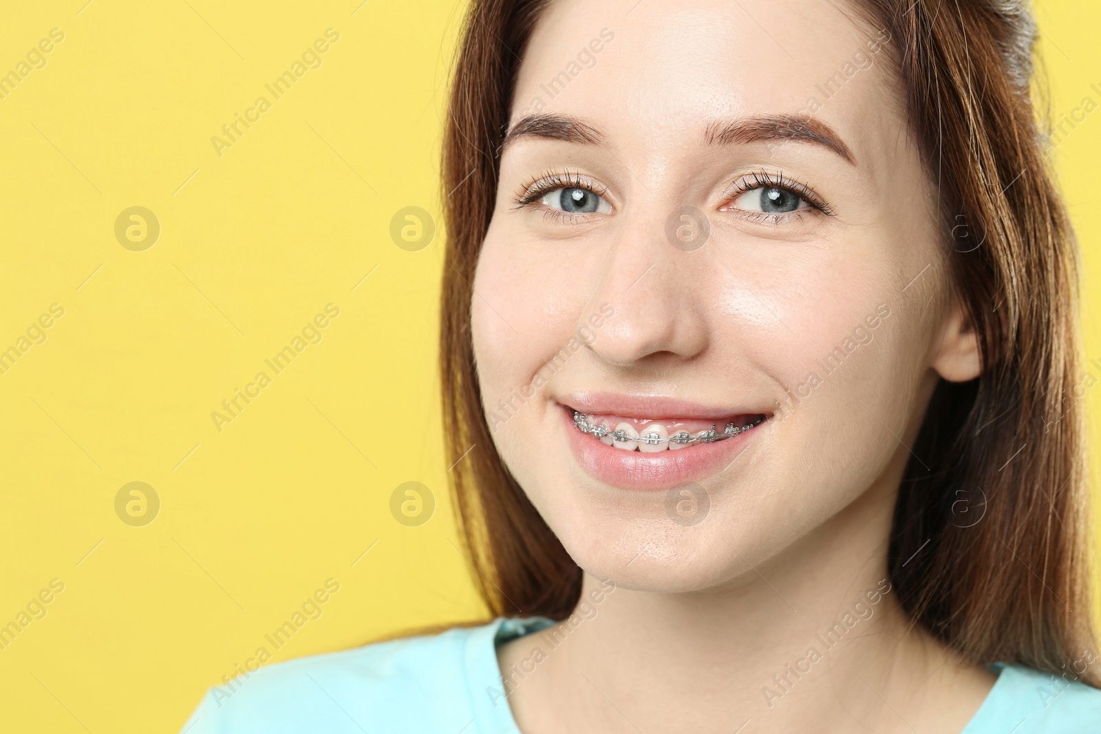Photo of Portrait of smiling woman with dental braces on yellow background, closeup. Space for text