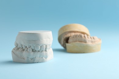 Photo of Dental model with gums on light blue background. Cast of teeth
