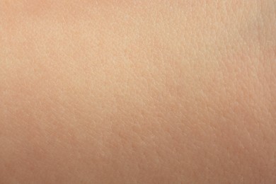 Photo of Texture of dry skin as background, macro view