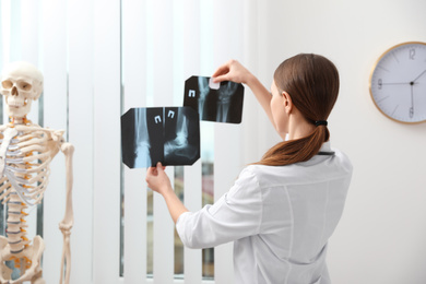 Photo of Orthopedist examining X-ray pictures near window in office