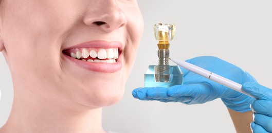 Image of Young woman with beautiful smile and dentist holding educational model of dental implant on light background, closeup. Banner design