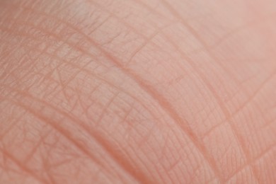 Photo of Texture of dry skin as background, macro view