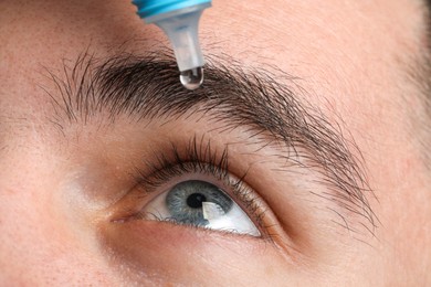 Photo of Young man applying medical eye drops from bottle, macro view