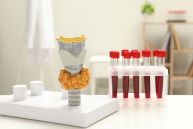 Photo of Endocrinology. Model of thyroid gland and samples of blood in test tubes on white table at clinic