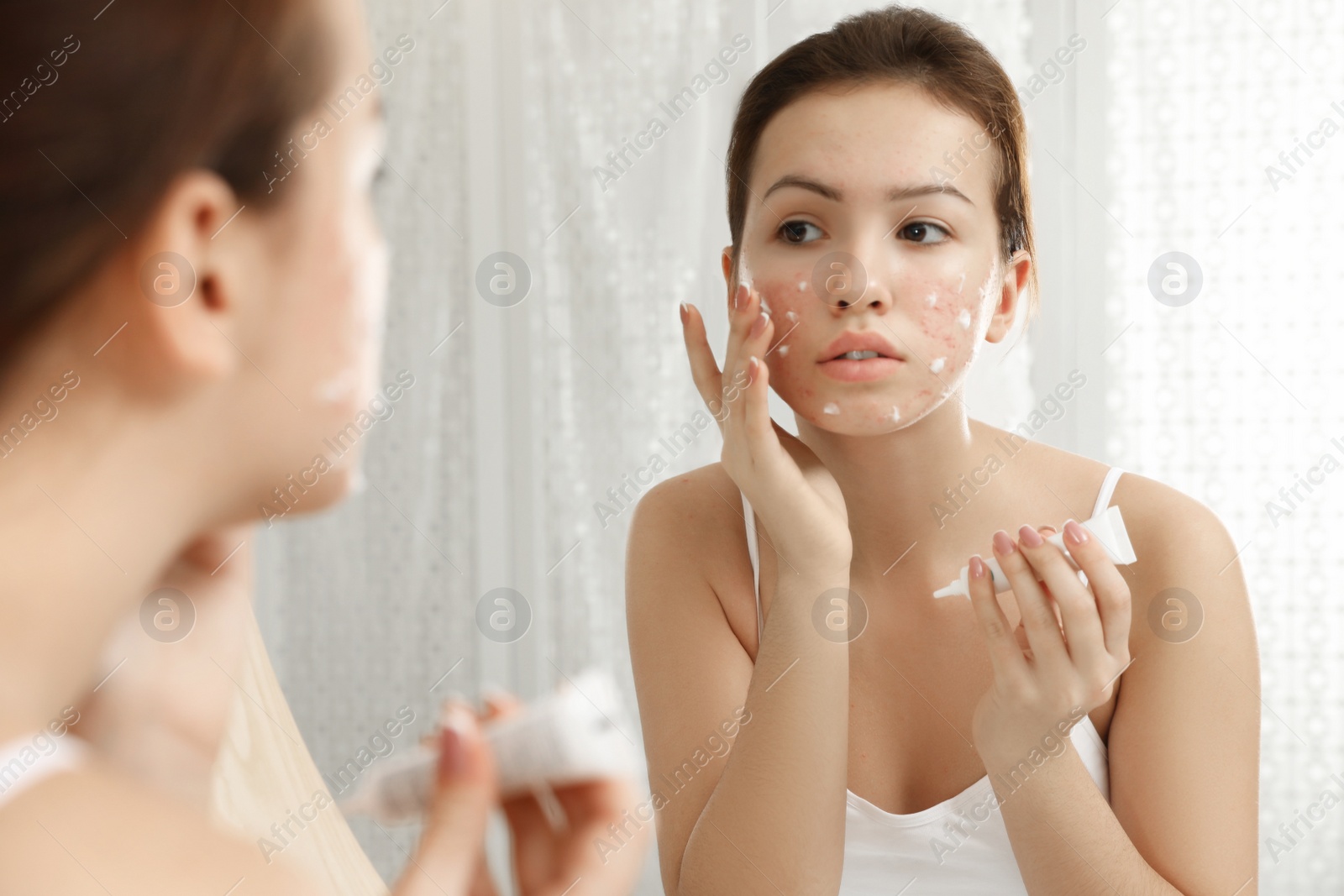 Photo of Teen girl with acne problem applying cream near mirror in bathroom