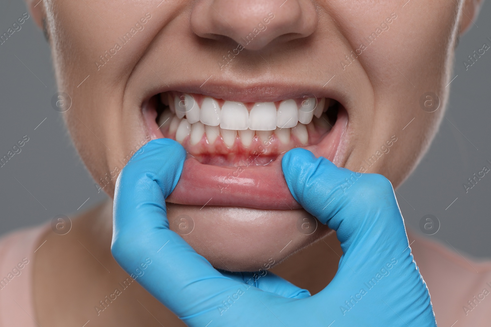 Photo of Woman showing healthy gums on gray background, closeup