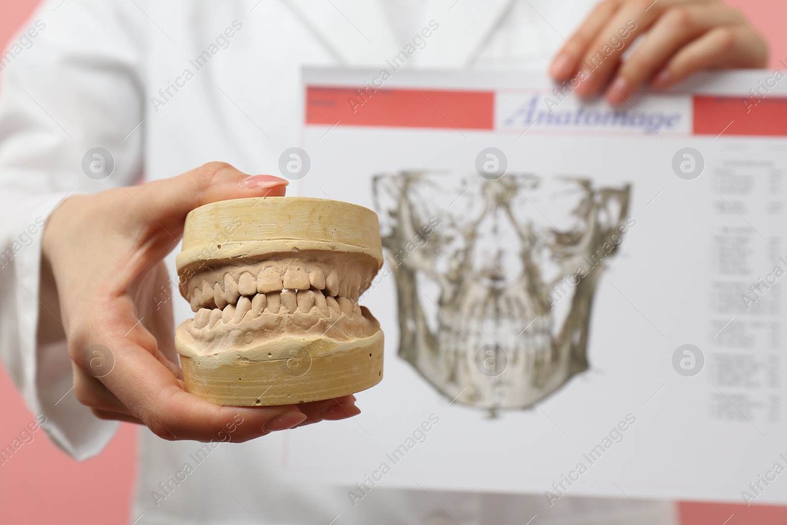 Photo of Doctor holding dental model with jaws and visualization of human maxillofacial section for dental analysis printed on paper against pink background, selective focus. Cast of teeth