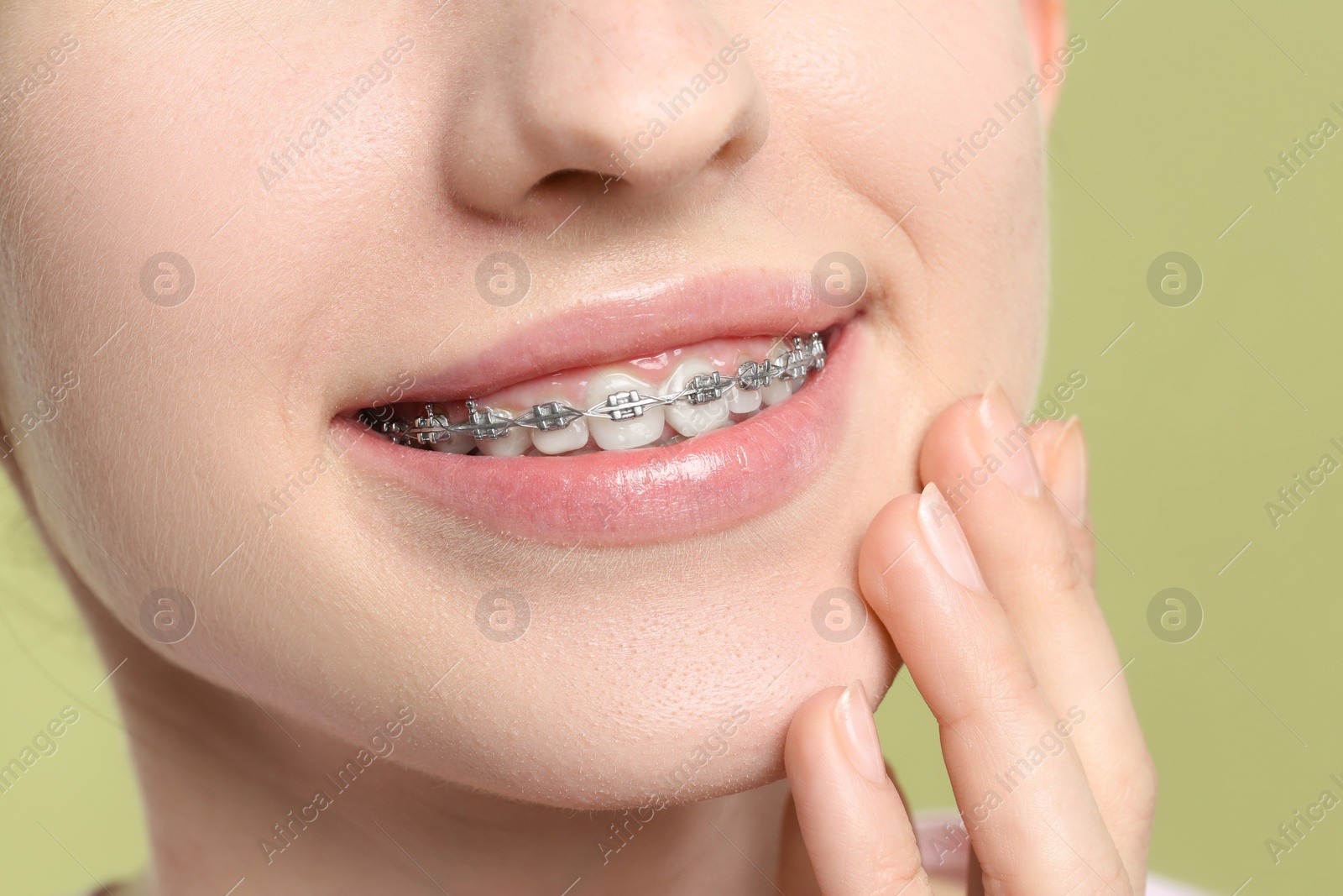 Photo of Smiling woman with dental braces on light green background, closeup