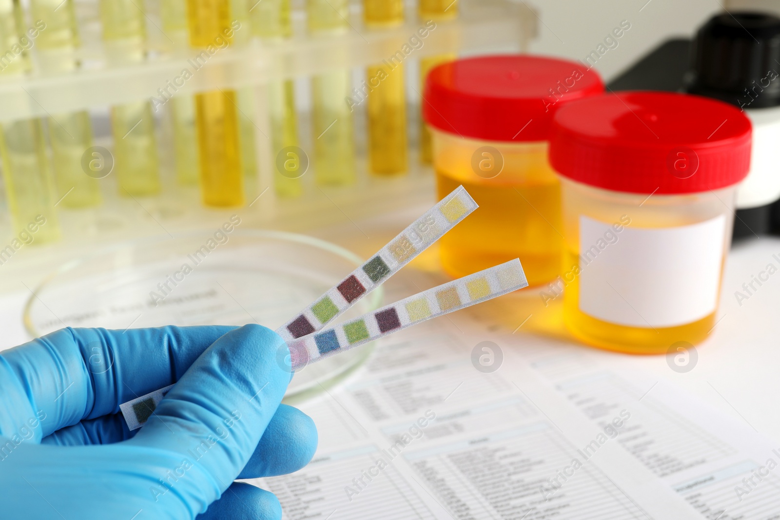 Photo of Nurse holding test strips at table, closeup. Urine analysis