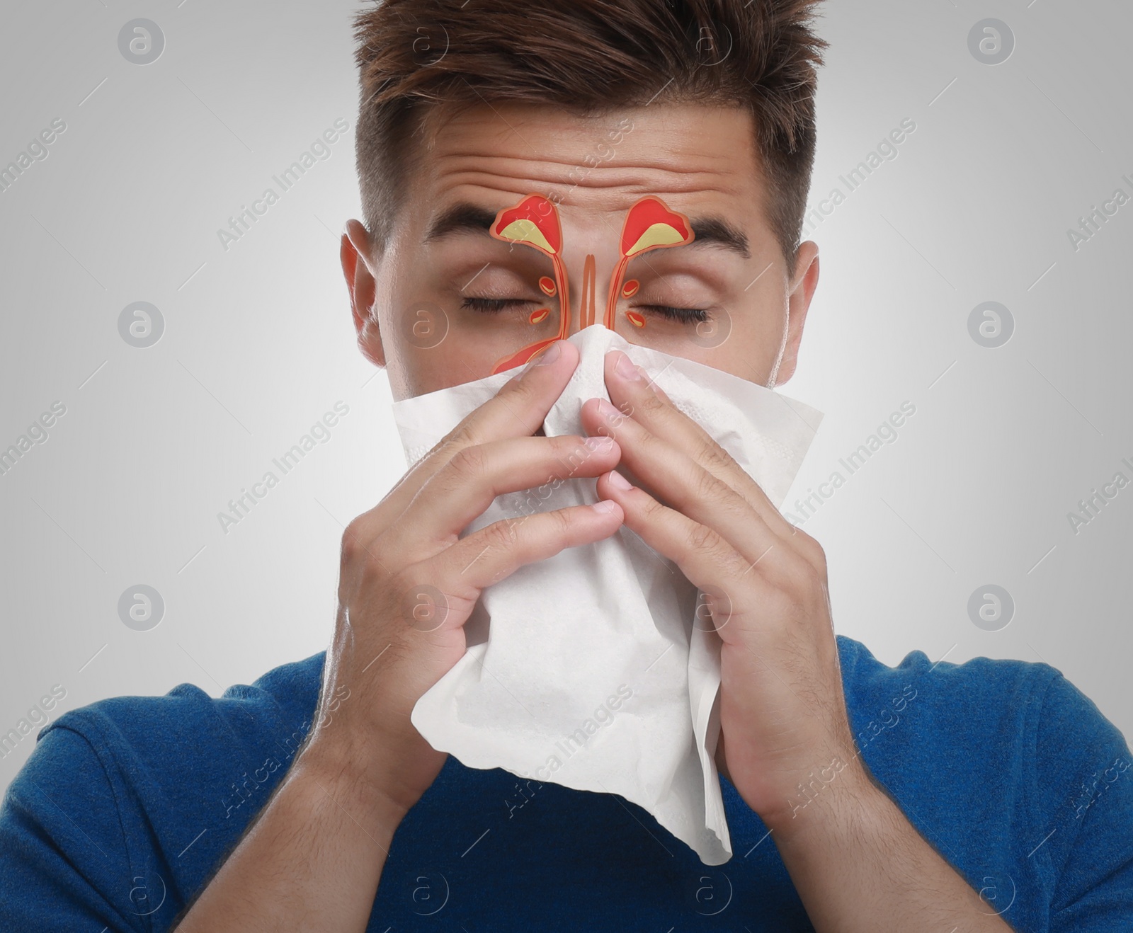 Image of Man suffering from runny nose as allergy symptom. Sinuses illustration on face