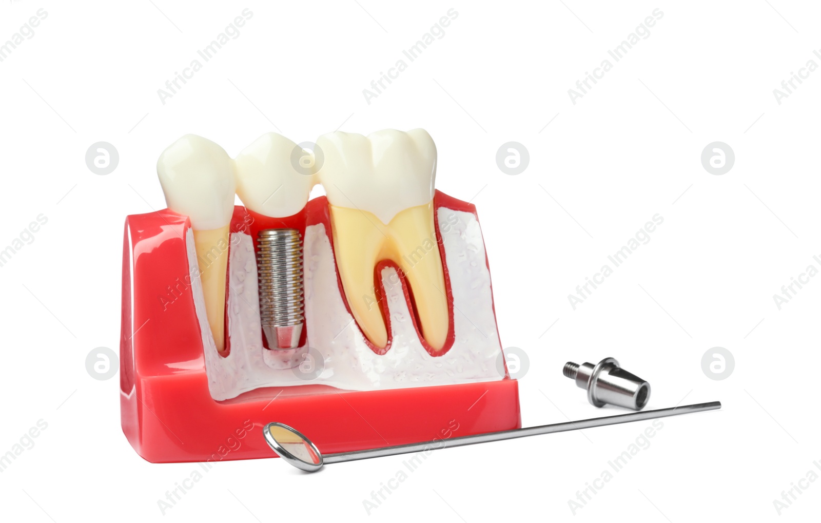 Photo of Educational model with post and crown of dental implant between teeth near mirror and abutment on white background