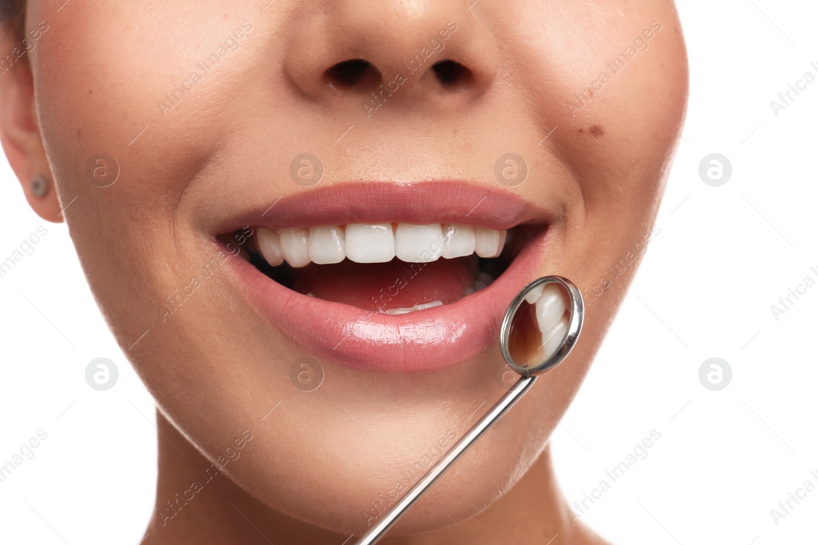 Photo of Young woman with mouth mirror on white background, closeup. Cosmetic dentistry