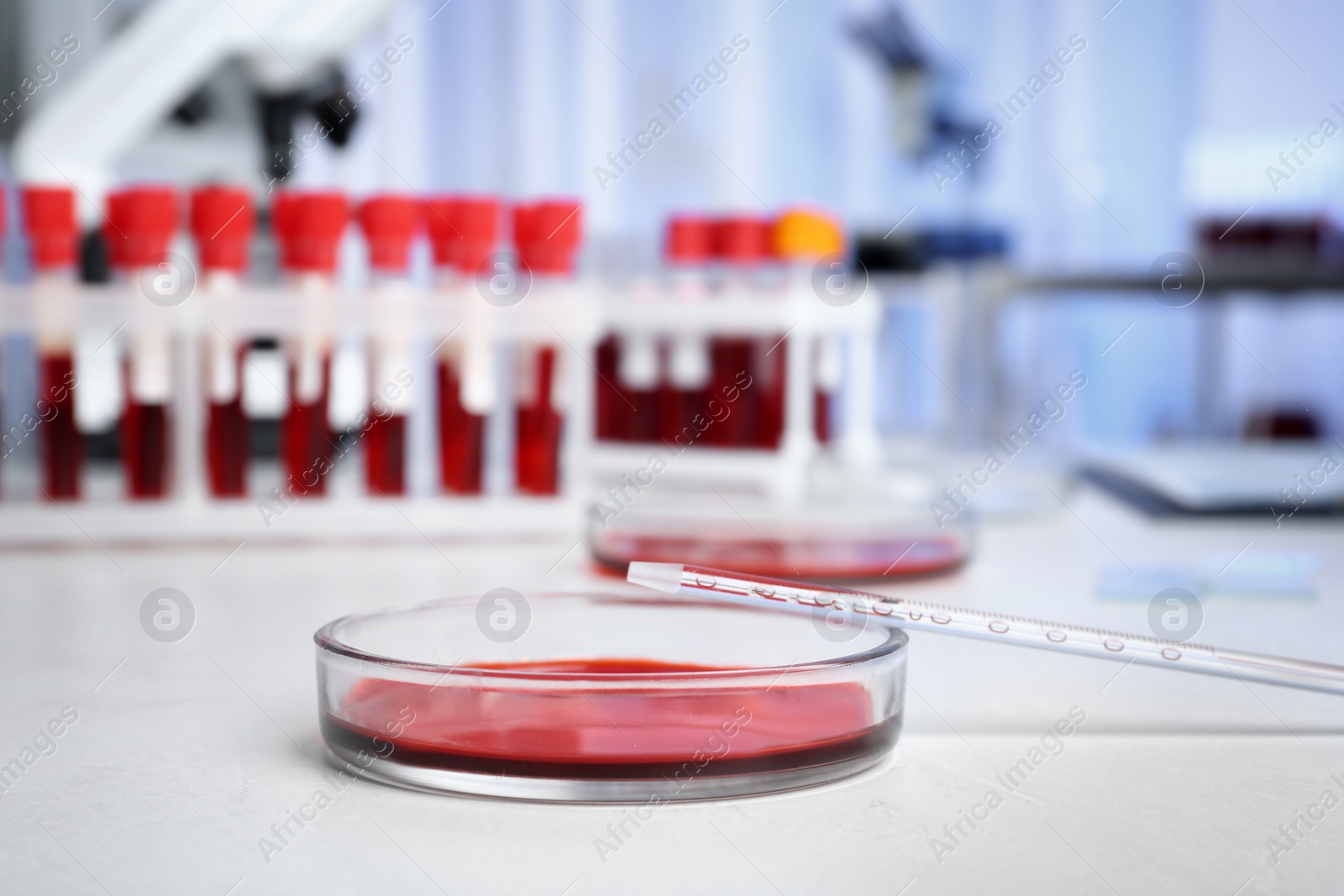 Photo of Petri dish with blood sample for analysis on table in laboratory